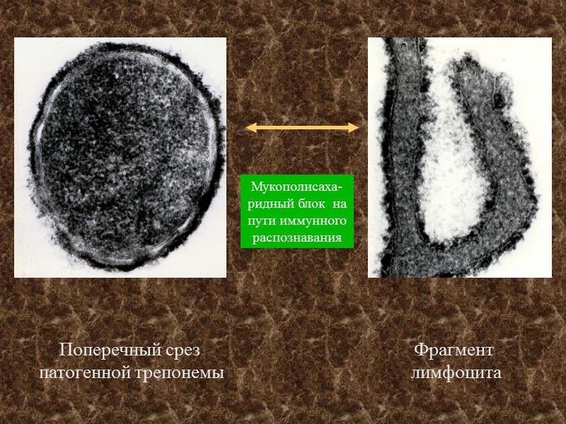 Мукополисаха-ридный блок  на пути иммунного распознавания Поперечный срез  патогенной трепонемы Фрагмент 